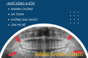 Tác hại của việc chậm trễ nhổ răng khôn liệu có đáng sợ