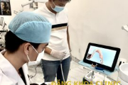 Thiết bị hiện đại Itero | Công nghệ quét dấu răng hiện đại nhất