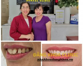 NHA KHOA ĐĂNG KHOA - ĐẾN ĐỂ ĐẸP
